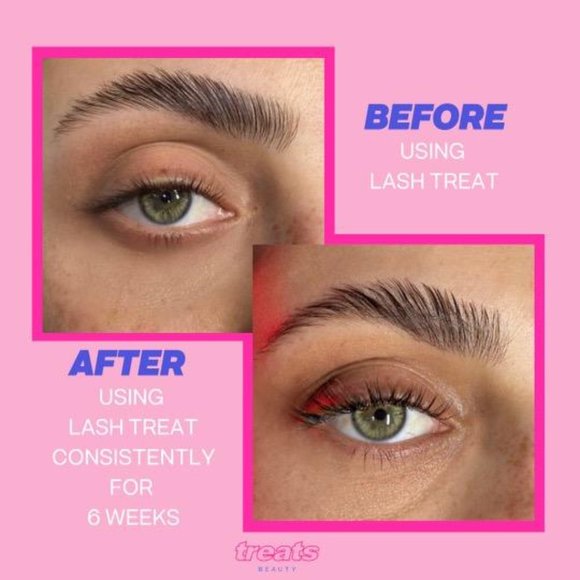 ❣️2/$36 NIB TREATS BEAUTY Lash Treat Rose Infused Lash Serum Full Size 3mL $65 - Picture 16 of 16